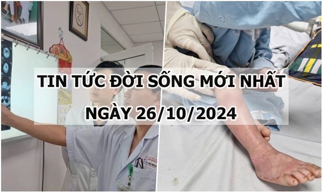 Tin tức đời sống 26/10/2024: Phẫu thuật cắt bỏ khối u thân cảnh hiếm gặp