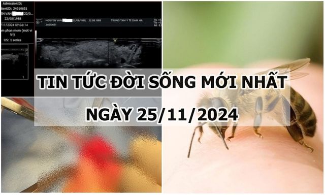 Tin tức đời sống 25/11/2024: Người đàn ông ngừng tim sau khi bị ong đốt