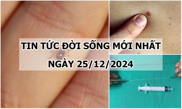 Tin tức đời sống 25/12: Phát hiện bị ung thư da từ chấm nhỏ trên mặt