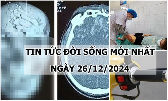 Tin tức đời sống 26/12: Vô tình vặn tay ga xe máy, bé 3 tuổi chấn thương sọ não