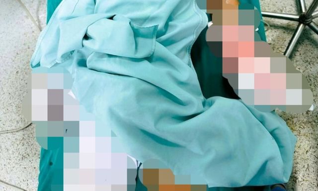 Nam sinh lớp 6 bị thương nặng vì mày mò chế pháo nổ, gia đình nói gì?