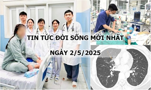 Tin tức đời sống 2/5: Cô gái bị sốc phản vệ nặng khi đang phẫu thuật nâng mũi