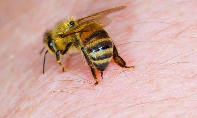 Bé trai 3 tuổi nguy kịch do bị loài ong tưởng như vô hại đốt