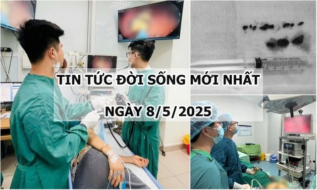 Tin tức đời sống 8/5: Nguyên nhân người phụ nữ bị đầy bụng, chán ăn kéo dài