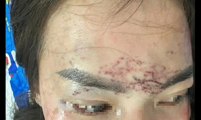 Vụ người phụ nữ bị bắt giữ, đánh đập, tạt axit nghi do ghen tuông: Thông tin mới nhất