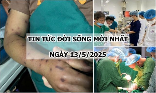 Tin tức đời sống ngày 13/5: Người đàn ông khó thở, tức ngực sau khi bị ong đốt hơn 150 vết