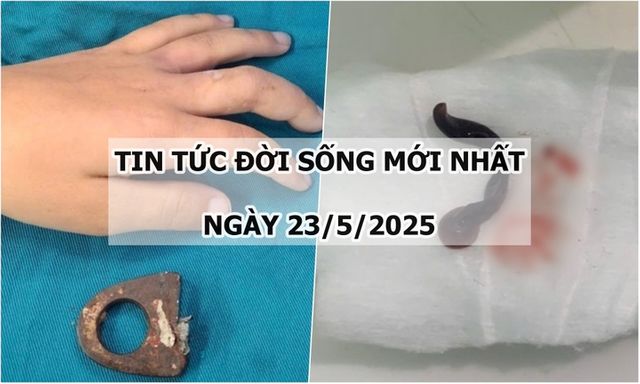 Tin tức đời sống 23/5: Vòng khóa siết chặt ngón tay bé trai, gia đình cưa cửa đưa đi cấp cứu