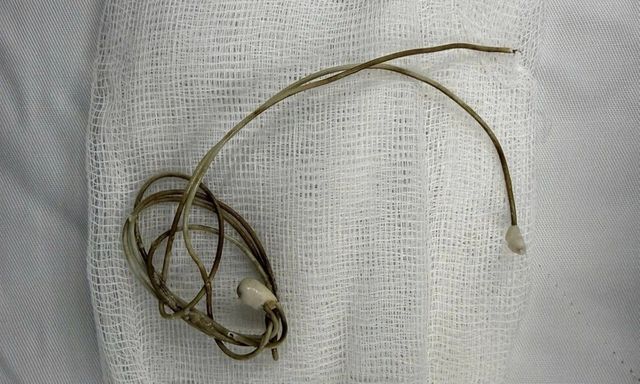 Tin tức đời sống 8/10: Gắp dây sạc trong bàng quang nam sinh 16 tuổi