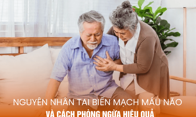 Nguyên nhân tai biến mạch máu não và cách phòng ngừa hiệu quả