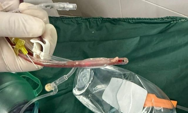  Sặc thức ăn tại nhà trẻ, bé gái 3 tuổi ở TP.HCM tử vong thương tâm