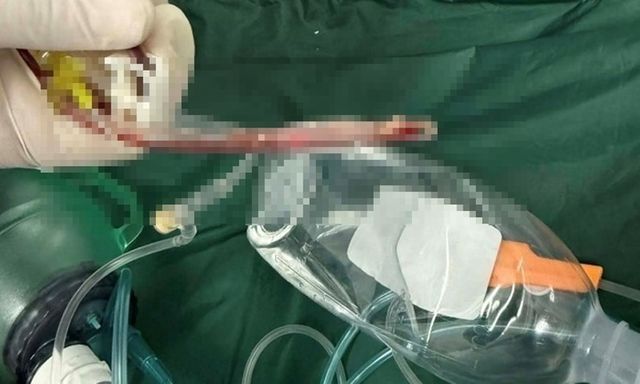 Vụ trẻ 3 tuổi tử vong chưa rõ nguyên nhân ở lớp mẫu giáo: Tình tiết mới nhất