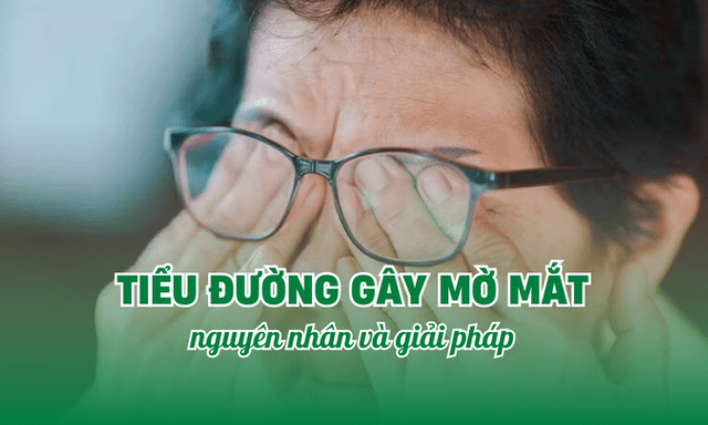 Tiểu đường gây mờ mắt: Nguyên nhân và giải pháp bảo vệ thị lực hiệu quả