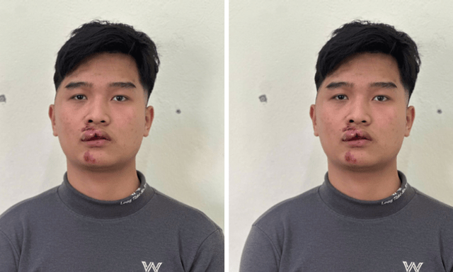 Khởi tố nam thanh niên tông thẳng xe vào CSGT khi bị dừng kiểm tra nồng độ cồn