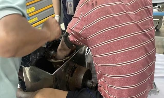 Hi hữu: Người đàn ông ở TP.HCM vác cả máy xay thịt đến bệnh viện cấp cứu