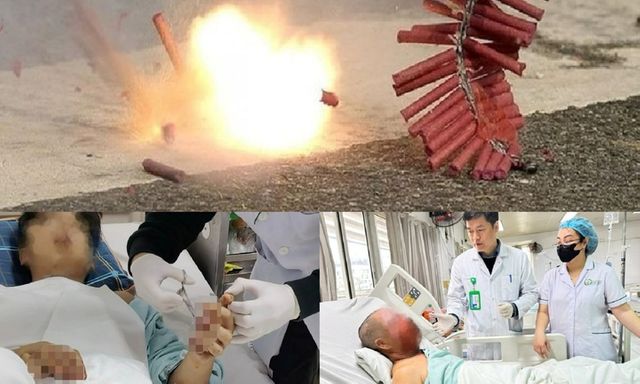 Cảnh báo nguy cơ tai nạn pháo nổ: Nhiều ca nguy kịch, di chứng nặng nề