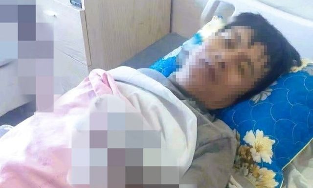 Tin tức đời sống 17/1: Nam công nhân bỏng nặng hai tay do phóng điện