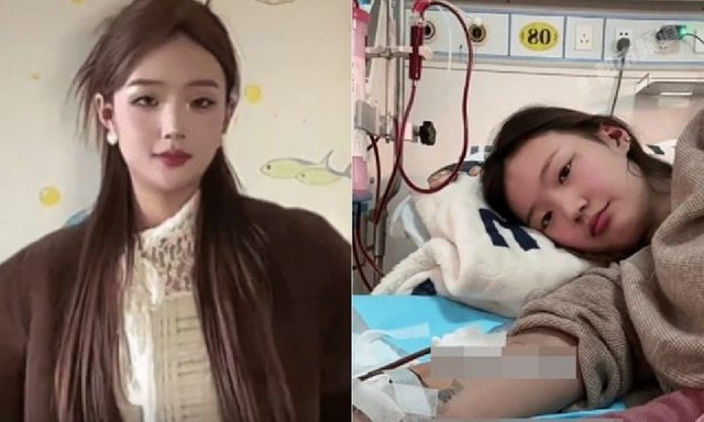 Tăng gần 30kg trong 6 tháng, cô gái trẻ bàng hoàng nhận kết quả suy thận giai đoạn cuối