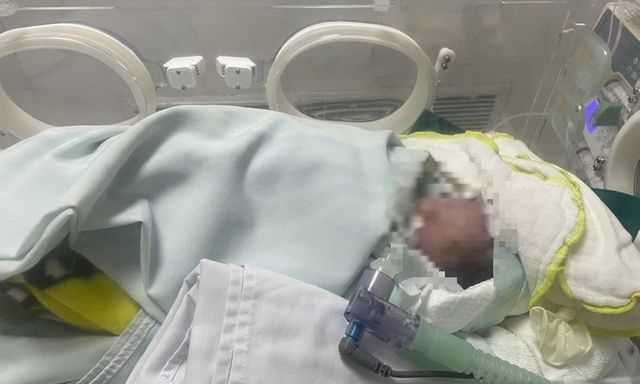 Trẻ sơ sinh bị bỏ rơi đã ngừng tim, người đầy bùn đất được 