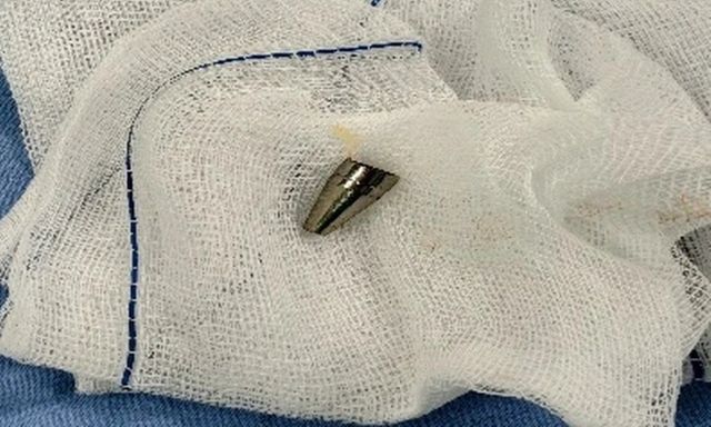 Thói quen nguy hiểm khi ngồi học khiến bé trai suýt mất mạng