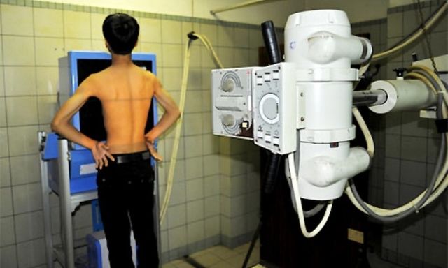 Bộ Y tế: Không lấy “thời gian chụp chiếu” làm căn cứ từ chối thanh toán BHYT