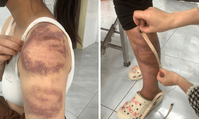 Tạm giữ người đàn ông nhiều lần trói, đánh con gái 13 tuổi và vợ đang mang thai