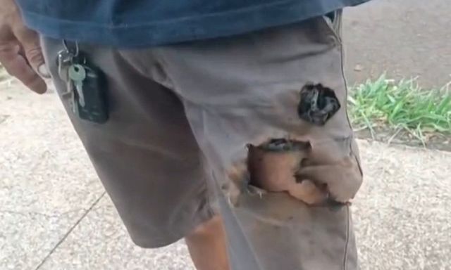 Điện thoại trong túi quần phát nổ, cứu mạng người đàn ông khỏi chó dữ tấn công