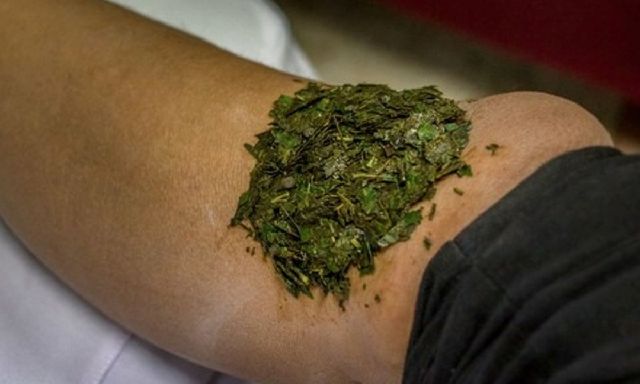 Hậu quả khôn lường khi tự ý chữa chấn thương bằng 