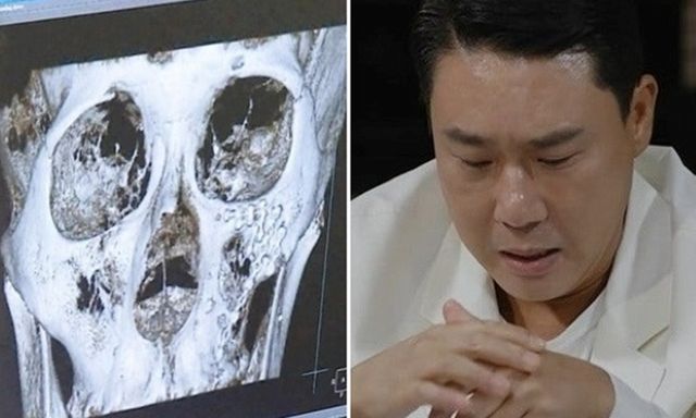 Nam ca sĩ đình đám ẩu đả kinh hoàng trong quán nhậu đến mức nhập viện