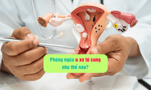 Phòng ngừa u xơ tử cung như thế nào?