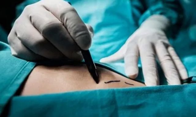 Chấn chỉnh việc thực hiện quy định về hiến, lấy, ghép mô, bộ phận cơ thể người 