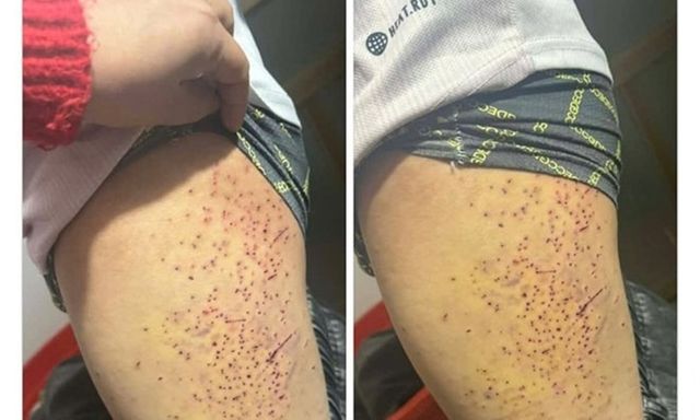 Xác minh thông tin học sinh nghi bị bạn dùng vật nhọn gây thương tích ở Lào Cai