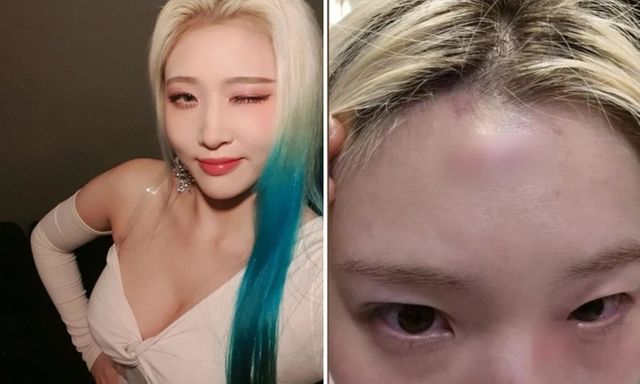 Nữ ca sĩ nhóm Rolling Quartz bị hành hung