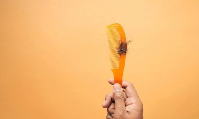 Mẹ rụng tóc, xuất hiện mảng hói to bằng bàn tay vì áp lực dạy con học bài