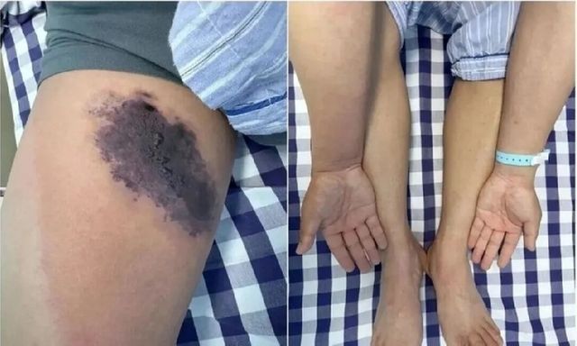 Mặc quần cũ không giũ, người đàn ông suýt mất mạng vì một 