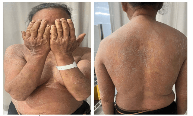 Sử dụng nhiều loại thuốc bôi mua qua mạng, người phụ nữ lãnh hậu quả