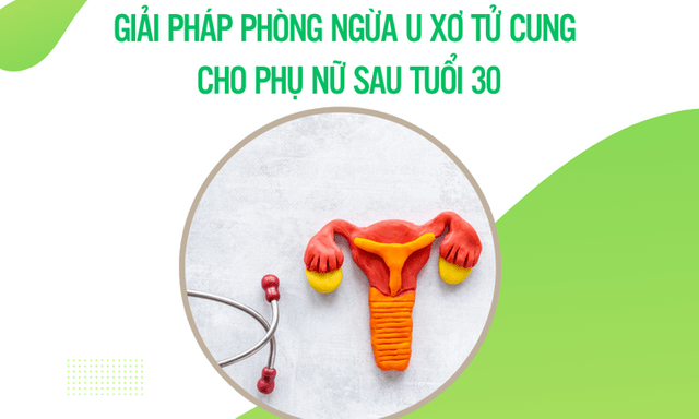 Giải pháp phòng ngừa u xơ tử cung cho phụ nữ sau tuổi 30