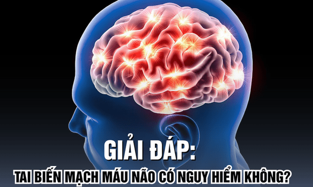 Giải đáp: Tai biến mạch máu não có nguy hiểm không?