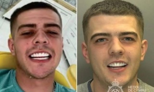 Tội phạm buôn ma túy bị bắt vì gửi ảnh khoe răng 