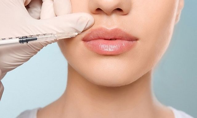 Thiếu nữ 18 tuổi hoại tử môi, rỉ mủ vì tiêm 