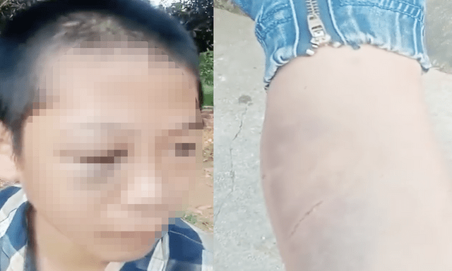 Vụ clip nam sinh lớp 6 ở Nghệ An kêu cứu, nghi bị bạo hành: Cơ quan chức năng vào cuộc