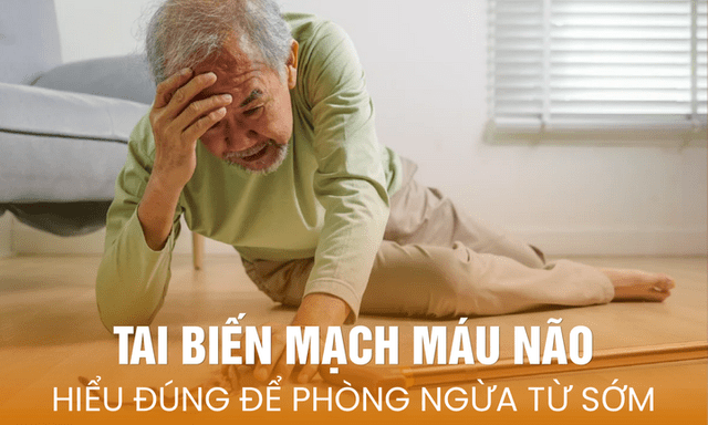 Tai biến mạch máu não: Hiểu đúng để phòng ngừa từ sớm