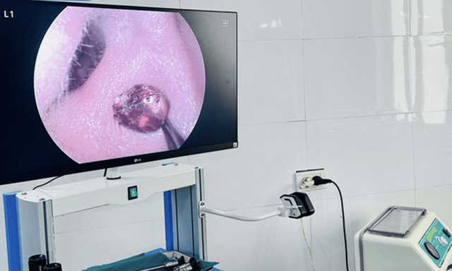 Đau tai đi khám, bệnh nhân hoảng hốt vì 
