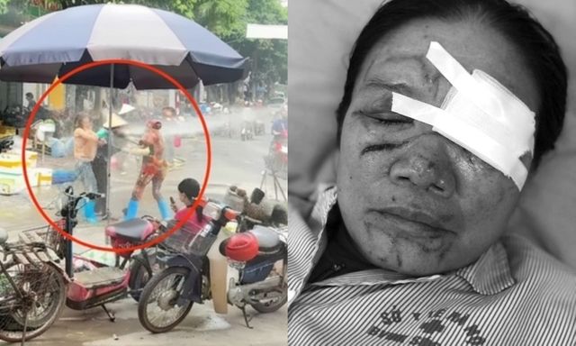 Vụ người phụ nữ dùng vòi nước cao áp xịt người bán rau ở Phú Thọ: Sức khỏe nạn nhân hiện ra sao?