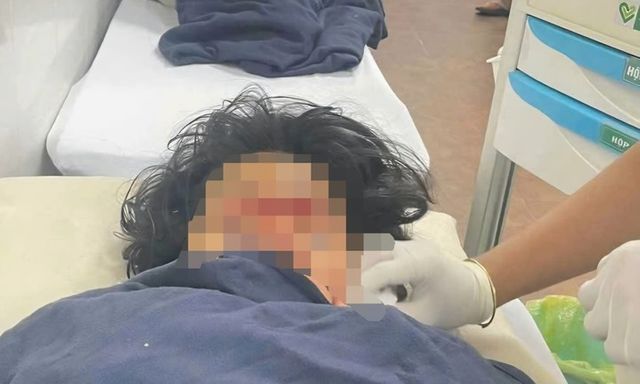 Điều tra nghi án nữ sinh lớp 11 dùng hung khí tấn công học sinh lớp 9