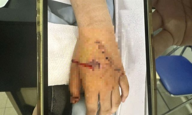 Giáo dục 24h: Tình tiết mới vụ nữ sinh hành hung bạn nhập viện ở Đắk Lắk