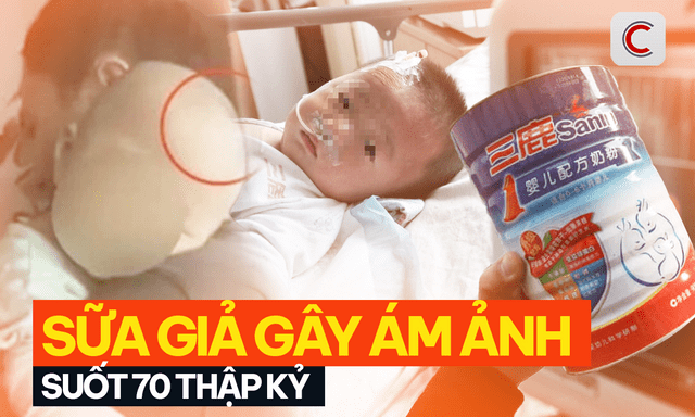 Những vụ bê bối sữa giả gây ám ảnh suốt 7 thập kỷ: Hàng loạt trẻ tử vong, ảnh hưởng trí tuệ, các giám đốc lĩnh án tử hình