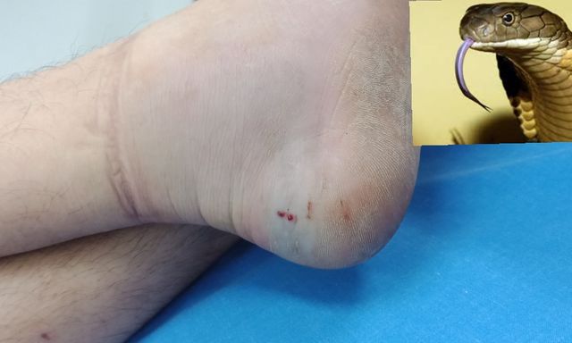 Thí sinh The Voice qua đời vì bị rắn độc cắn trong phòng ngủ