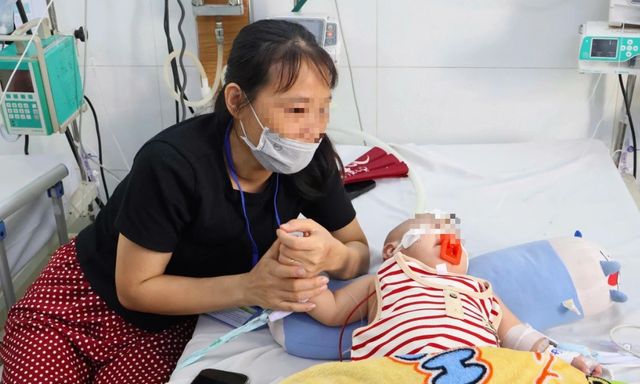 Nóng: 17.000 ca mắc, 8 ca tay chân miệng tử vong, Thứ trưởng Bộ Y tế vào TPHCM chống dịch khẩn