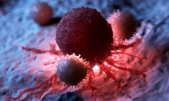 Khi ung thư mới gõ cửa, cơ thể thường có 3 dấu hiệu SỚM