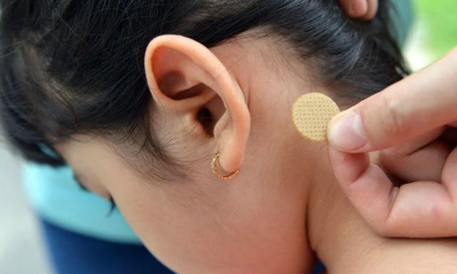 Bé gái 7 tuổi loạn thần, sốt cao sau khi sử dụng miếng dán chống say tàu xe: Bác sĩ cảnh báo sai lầm nguy hiểm bố mẹ mắc phải